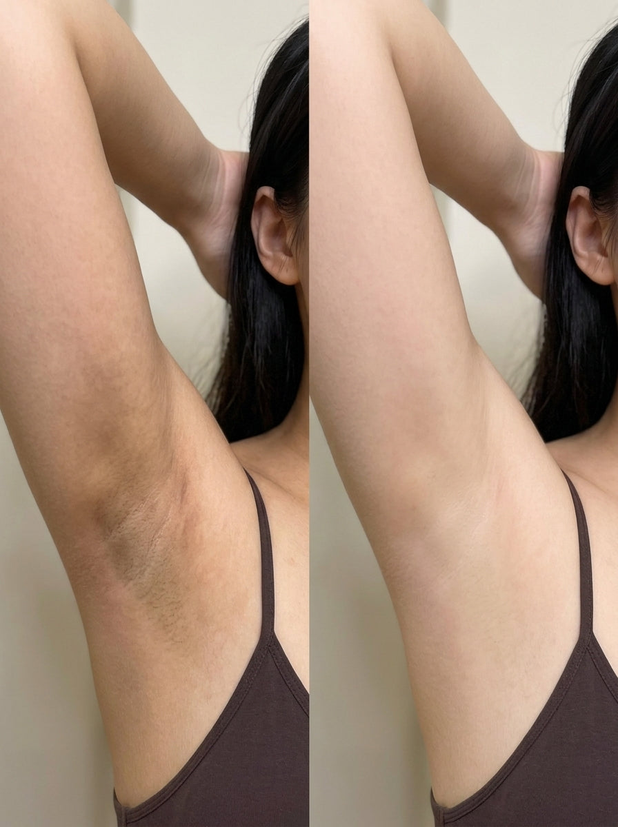 Antes e depois pele